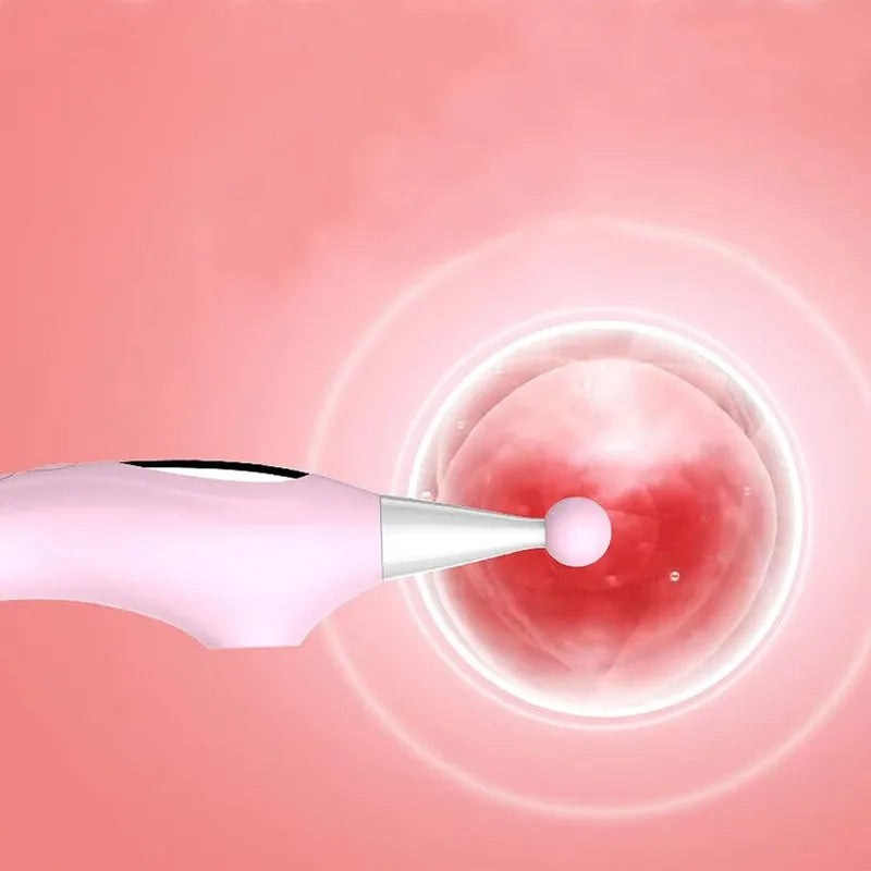 Vibrateur 3 en 1 clitoris et Pont G - Secwell – NaNa Pinpoint Secwell Sensations plus